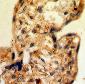 CSF2RA Rabbit Polyclonal Antibody