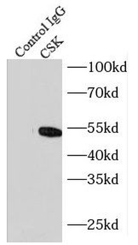 CSK Rabbit Polyclonal Antibody