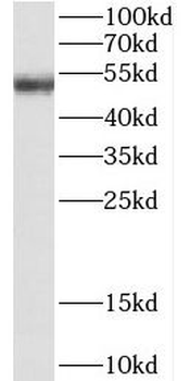 CSK Rabbit Polyclonal Antibody