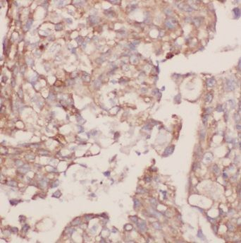 CSK Rabbit Polyclonal Antibody