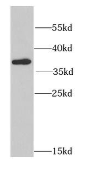 CSNK2A2 Rabbit Polyclonal Antibody
