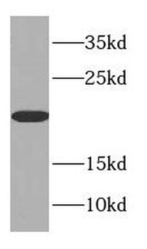 CSRP1 Rabbit Polyclonal Antibody