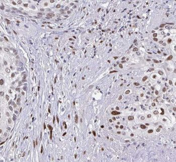 CSRP1 Rabbit Polyclonal Antibody