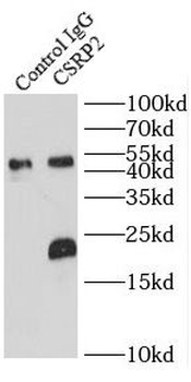CSRP2 Rabbit Polyclonal Antibody