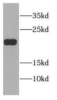 CSRP2 Rabbit Polyclonal Antibody