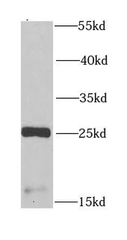 CSRP3 Rabbit Polyclonal Antibody