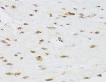 CSRP3 Rabbit Polyclonal Antibody