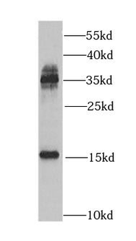 CST1 Rabbit Polyclonal Antibody