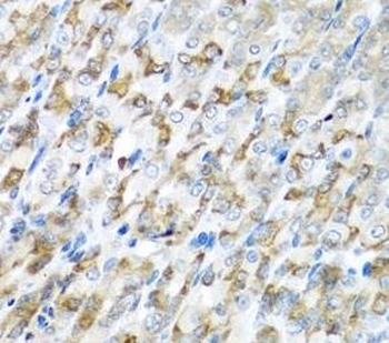 CST1 Rabbit Polyclonal Antibody