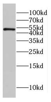 CTBP2 Rabbit Polyclonal Antibody
