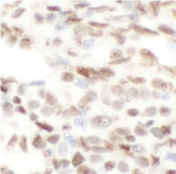 CTBP2 Rabbit Polyclonal Antibody