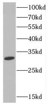 CTDSP2 Rabbit Polyclonal Antibody