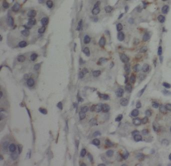 CTDSP2 Rabbit Polyclonal Antibody