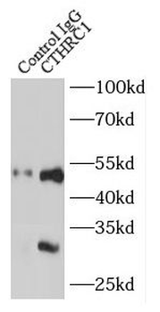 CTHRC1 Rabbit Polyclonal Antibody