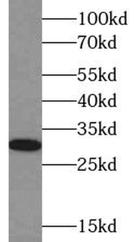 CTHRC1 Rabbit Polyclonal Antibody