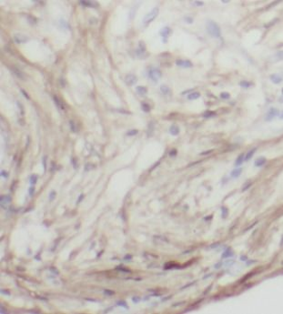 CTHRC1 Rabbit Polyclonal Antibody
