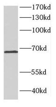 CTNNBL1 Rabbit Polyclonal Antibody