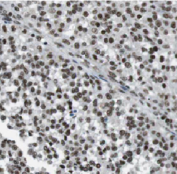CTNNBL1 Rabbit Polyclonal Antibody