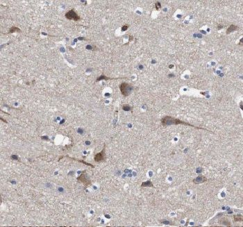 C1QTNF4 Rabbit Polyclonal Antibody