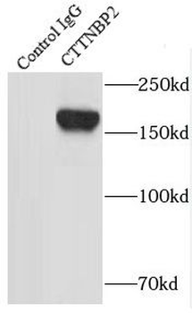CTTNBP2 Rabbit Polyclonal Antibody