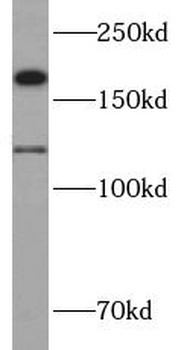 CTTNBP2 Rabbit Polyclonal Antibody