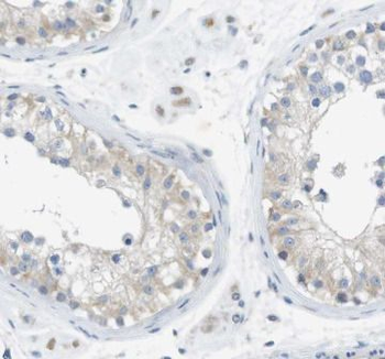 CTTNBP2 Rabbit Polyclonal Antibody