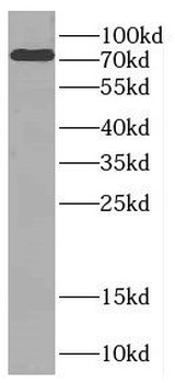 CTTNBP2NL Rabbit Polyclonal Antibody