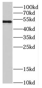 CELF1 Rabbit Polyclonal Antibody