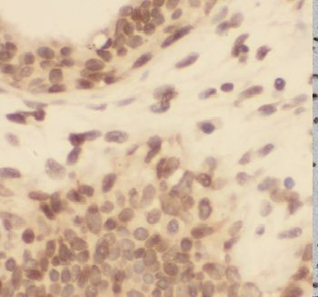 CELF1 Rabbit Polyclonal Antibody