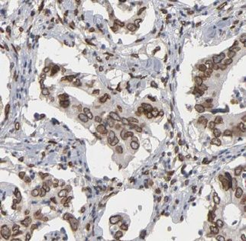 CUL1 Rabbit Polyclonal Antibody