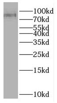 CUL2 Rabbit Polyclonal Antibody