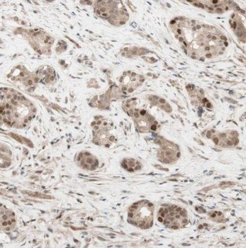 CUL2 Rabbit Polyclonal Antibody