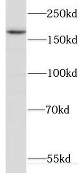 CUL7 Rabbit Polyclonal Antibody