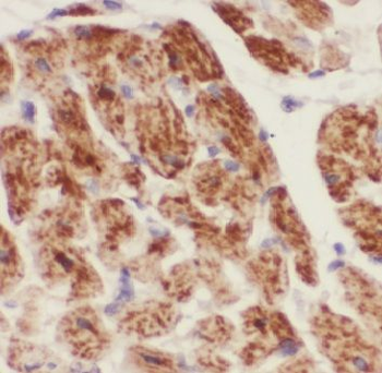 CUL7 Rabbit Polyclonal Antibody