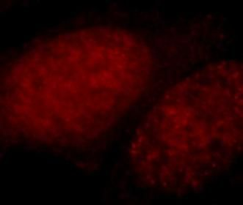 CUX1 Rabbit Polyclonal Antibody