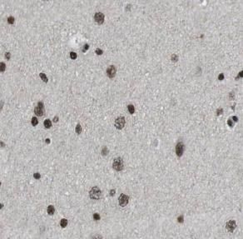 CUX1 Rabbit Polyclonal Antibody