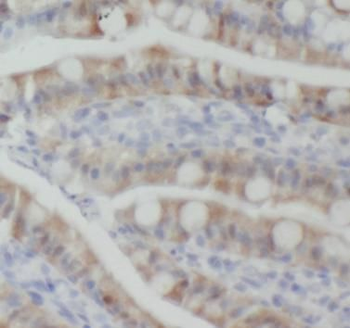 CX3CL1 Rabbit Polyclonal Antibody