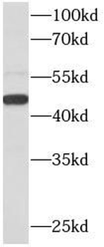 CX3CR1 Rabbit Polyclonal Antibody