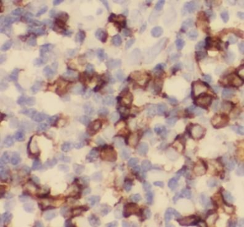 CX3CR1 Rabbit Polyclonal Antibody