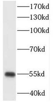 CXADR Rabbit Polyclonal Antibody