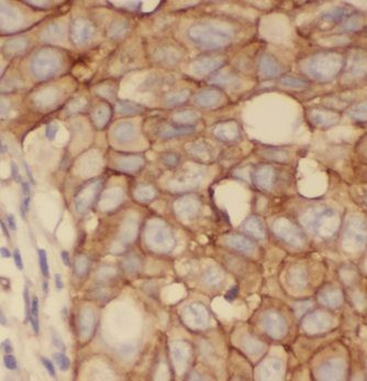 CXADR Rabbit Polyclonal Antibody