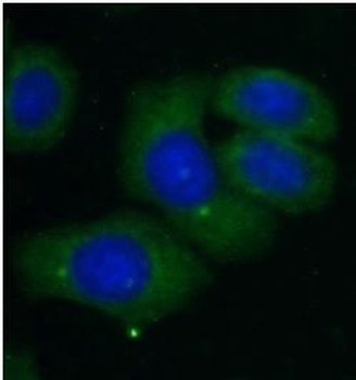CXCL14 Rabbit Polyclonal Antibody