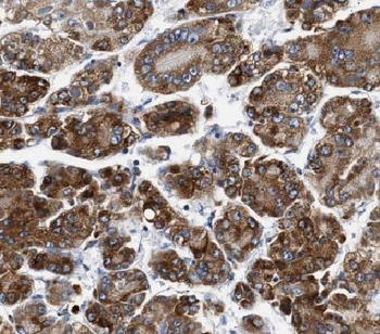 CXCL14 Rabbit Polyclonal Antibody
