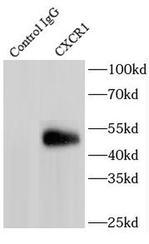 CXCR1 Rabbit Polyclonal Antibody
