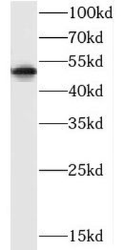 CXCR1 Rabbit Polyclonal Antibody