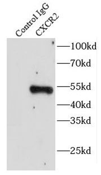 CXCR2 Rabbit Polyclonal Antibody
