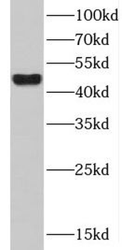 CXCR2 Rabbit Polyclonal Antibody