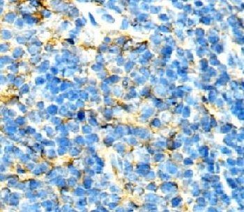 CXCR2 Rabbit Polyclonal Antibody