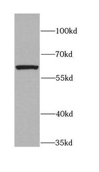 CXCR4 Rabbit Polyclonal Antibody