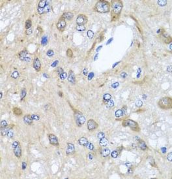 CXCR4 Rabbit Polyclonal Antibody